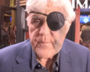 Visage tuméfié de Jay Leno